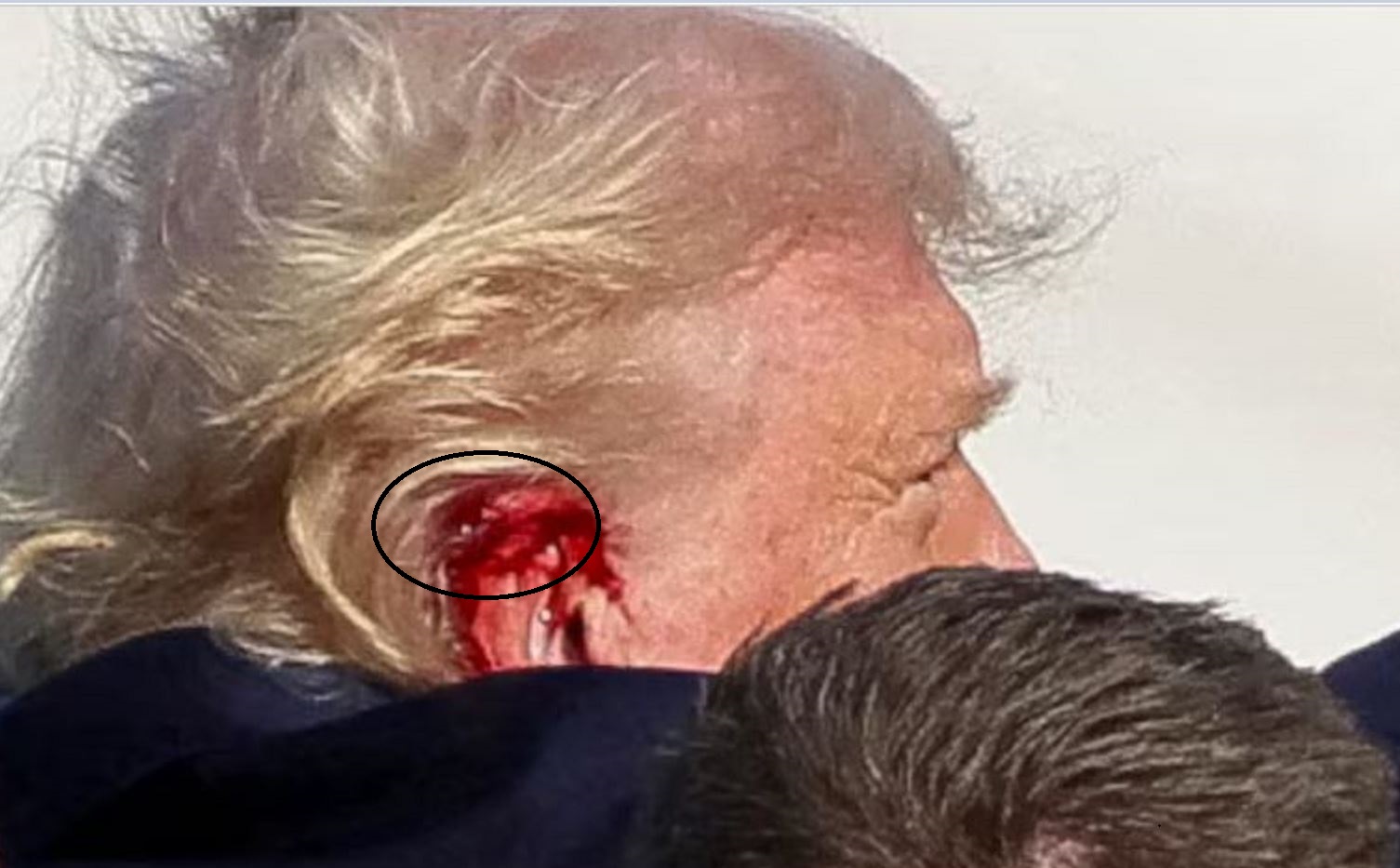 President Trump, Shot In The Ear, Butler, PA, 2 Of 2, July 13, 2024.jpg